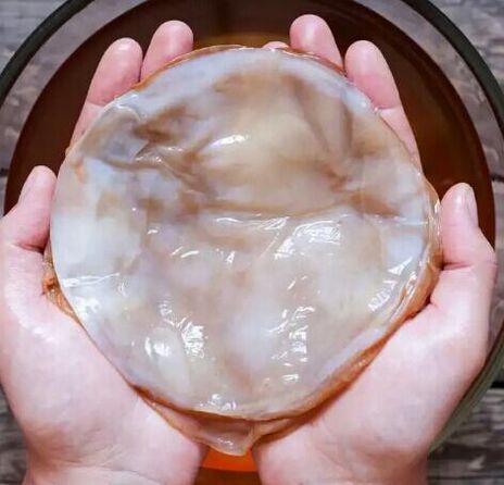 nagų grybelis kombucha