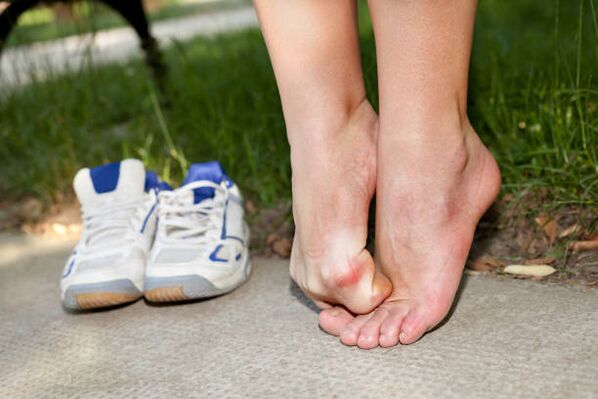 niežulys tarp kojų grybelio simptomai